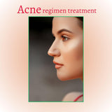 Deep Treatment Acne Cleansing Foam Cleanser | Korean Skin Care for All Skin Types