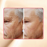 Thick As Thieves Pure Glycolic Acid Lactic Acid Extreme Gel Peel - 50ml | Korean Skin Care for All Skin Types