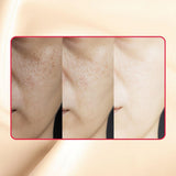 Thick As Thieves Pure Glycolic Acid Lactic Acid Extreme Gel Peel | Korean Skin Care for All Skin Types