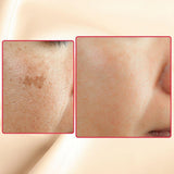 Acid Peel Eraser Combo | Korean Skin Care for All Skin Types