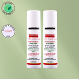 Perfect Trifecta Acne Peel | Korean Skin Care for All Skin Types