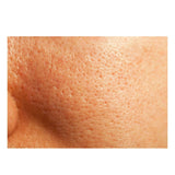 Thick As Thieves Pure Glycolic Acid Lactic Acid Extreme Gel Peel | Korean Skin Care for All Skin Types