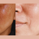 Ultra-Advanced Anti-Aging Daily Resurfacing Pads AHA + BHA + PHA+ Hyaluronic Acid + Niacinamide + Green Tea - I Jar | Korean Skin Care for All Skin Types