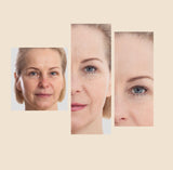 Before and after a woman with dark spots and wrinkles