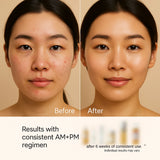 Before and after comparison of a woman's face with text indicating results from a consistent AM+PM regimen.