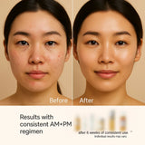 Before and after of woman showing improved clear skin after Korean skincare routine