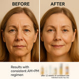 Before and after comparison of a woman's face with text indicating results from a consistent skincare regimen.