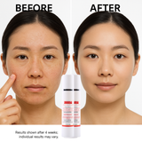 Before and after comparison of a person's face with skincare products displayed.