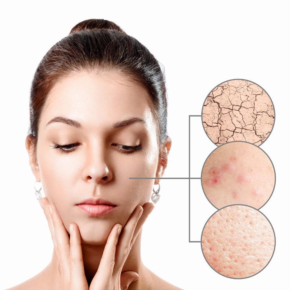VITAMIN-B5.-DRY-SKIN