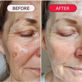 gymsegbe | Luminous Mighty Punch Serum | woman before and after