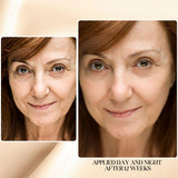Before and after results from Gymsegbe Luminous Mighty Punch Serum – smooth lines and wrinkles