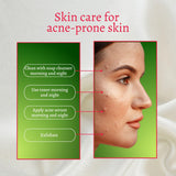 Acne SGymsegbe Acne Set full skincare routine for acne-prone skin