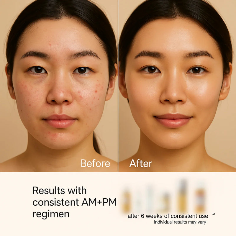 Before and after comparison of a woman's face with text indicating results from a consistent AM+PM regimen.