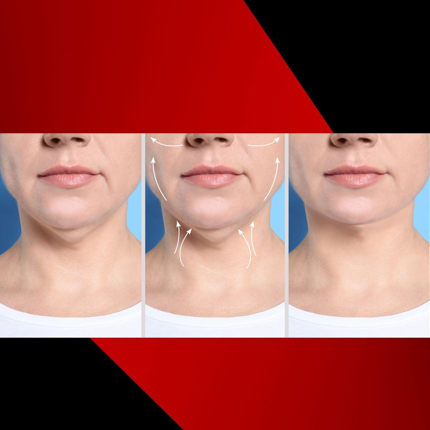 different stages of the results and how the  neck cream works to lift sagging skin and wrinkled neck