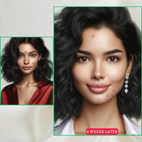 Gymsegbe Acne Set full skincare routine for acne-prone skin