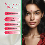 Gymsegbe Acne Set full skincare routine for acne-prone skin