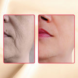 Before and after results from Gymsegbe Luminous Mighty Punch Serum – fade dark spots and fine lines