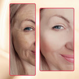 Before and after using Luminous Mighty Punch Serum on dark spots