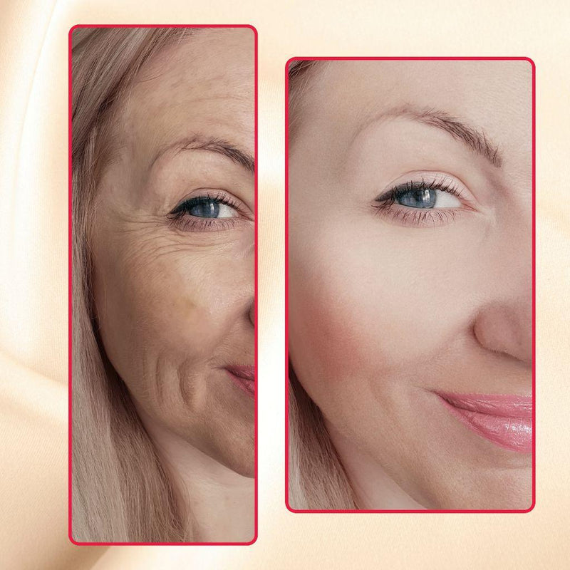 Before and after using Luminous Mighty Punch Serum on dark spots