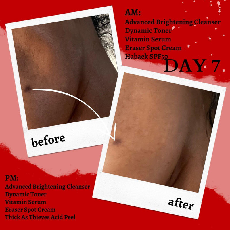 before and after applying vitamin serum seven days 