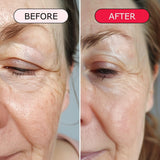 gymsegbe | Luminous Mighty Punch Serum. Before and after